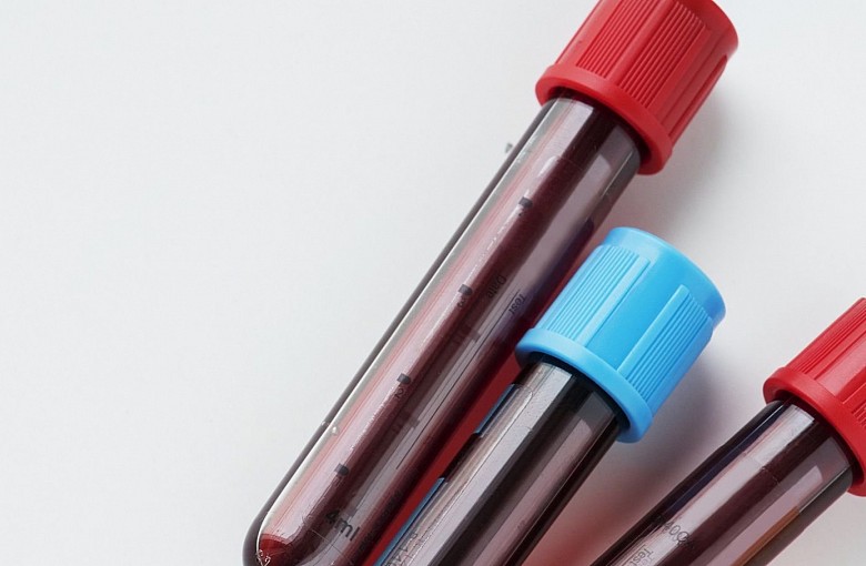 Krwawe przedpołudnie w Mechaniku