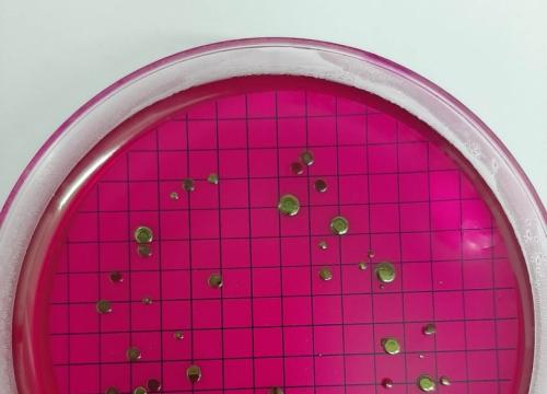 W świecie wirusów i  bakterii