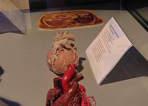 Body Worlds & The Cycle of Life